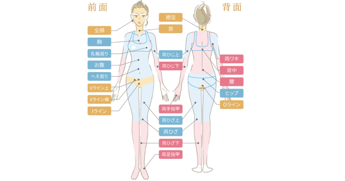 ルシアクリニックの脱毛可能部位